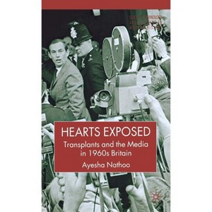 Hearts Exposed - (Science, Technology and Medicine in Modern History) by  A Nathoo (Hardcover) - 1 of 1