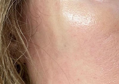 Guest review image 1 of 4, zoom in