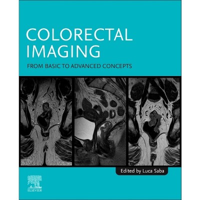 Colorectal Imaging - by  Luca Saba (Paperback)