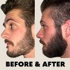 Beard Club Beard Derma Roller - 3 of 4