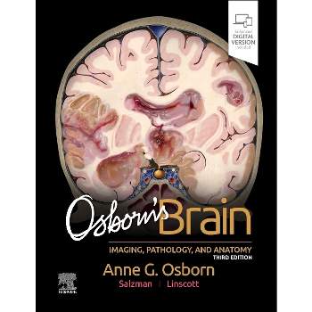 Osborn's Brain - 3rd Edition by  Anne G Osborn & Luke L Linscott & Karen L Salzman (Hardcover)