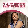 Gold Bond - Medicated Diabetics Dry Skin Relief Foot Cream, 3.4 Oz - 3 of 4