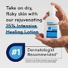 AmLactin Intensive Healing Exfoliating + Hydrating AHA Body Lotion - 14.1oz - 4 of 4