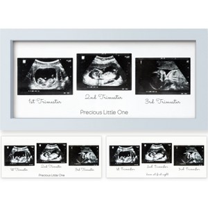 KeaBabies Trio Baby Sonogram Picture Frame, Baby Ultrasound Picture Frames for Baby Nursery, Mom to Be Gifts - 1 of 4