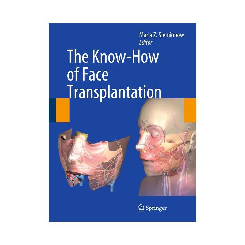 The Know-How of Face Transplantation - by  Maria Z Siemionow (Hardcover), 1 of 2