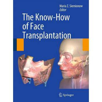The Know-How of Face Transplantation - by  Maria Z Siemionow (Hardcover)