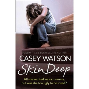 Skin Deep - by  Casey Watson (Paperback) - 1 of 1