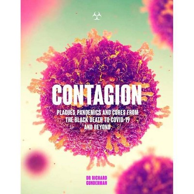 Contagion - by  Richard Gunderman (Paperback)