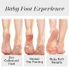 Baby Foot Original Exfoliation Foot Peel (PACK OF 2) Callus Remover for Rough Cracked | Dead skin Removal | Foot Peeling Mask (Lavender Scented) - 4 of 4