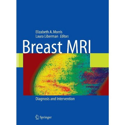 Breast MRI - by  Laura Liberman (Hardcover)