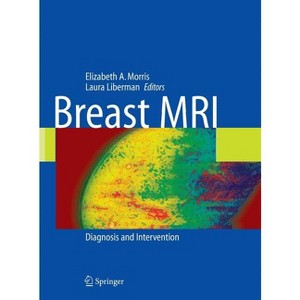 Breast MRI - by  Laura Liberman (Hardcover) - 1 of 1