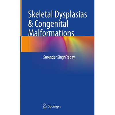 Skeletal Dysplasias & Congenital Malformations - by  Surender Singh Yadav (Hardcover)