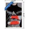 Trends International DC Comics Batman - Bandages Framed Wall Poster Prints - 3 of 4