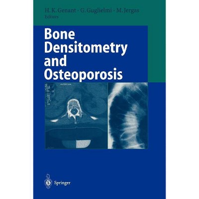 Bone Densitometry and Osteoporosis - by  Harry K Genant & Giuseppe Guglielmi & Michael Jergas (Paperback)