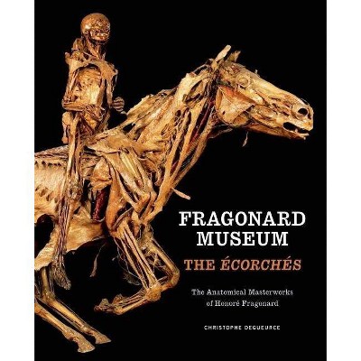 Fragonard Museum: The Écorchés - by  Christophe Degueurce (Hardcover)