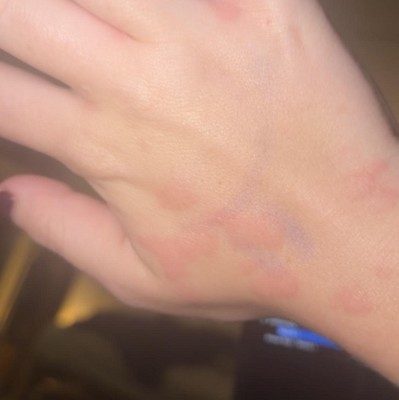 Guest review image 1 of 2, zoom in