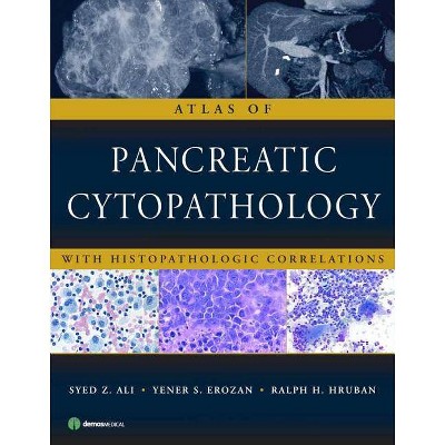 Atlas of Pancreatic Cytopathology - by  Syed Z Ali & Yener S Erozan & Ralph H Hruban (Hardcover)