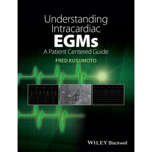 Understanding Intracardiac Egms - by  Fred M Kusumoto (Paperback) - 1 of 1