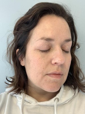 dr pimple popper target