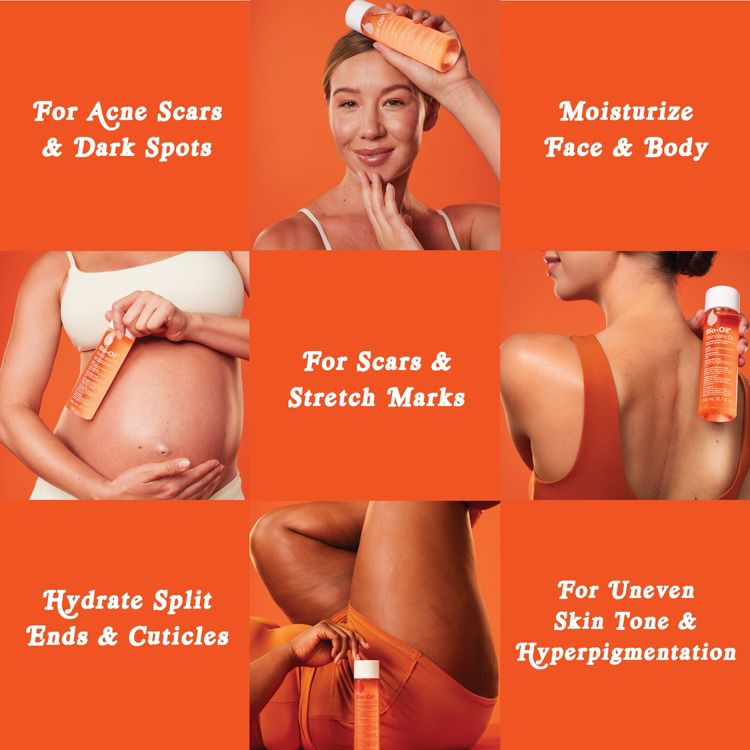 Bio-Oil Skincare Body Oil for Scars and Stretch Marks, Dark Spot Corrector with Vitamins A, E and Calendula, 6 of 9
