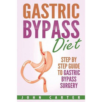 Gastric Bypass Diet - (Bariatric Cookbook) by  John Carter (Paperback)