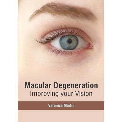 Macular Degeneration: Improving Your Vision - by  Veronica Martin (Hardcover)