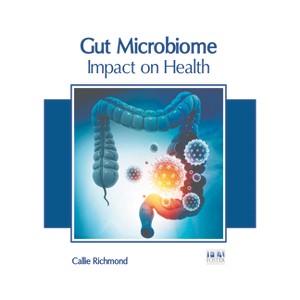 Gut Microbiome: Impact on Health - by  Callie Richmond (Hardcover) - 1 of 1