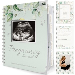 KeaBabies Pregnancy Journal, Pregnancy Announcements, 90 Pages Hard Cover Pregnancy Book For Mom To Be Gift - 1 of 4