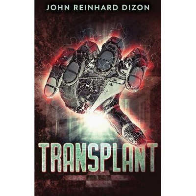 Transplant - 2nd Edition by  John Reinhard Dizon (Paperback)