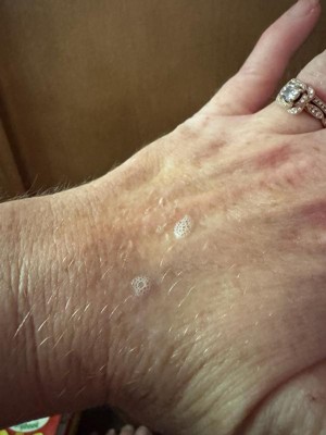 Guest review image 2 of 2, zoom in