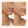 Peach & Lily Transparen-C Pro Spot Treatment - 0.67 fl oz - Ulta Beauty - 4 of 4