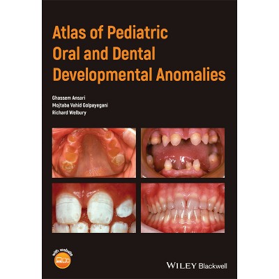 Atlas of Pediatric Oral and Dental Developmental Anomalies - by  Ghassem Ansari & Mojtaba Vahid Golpayegani & Richard Welbury (Paperback)