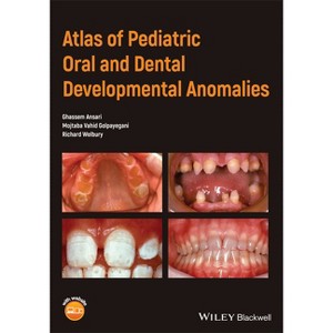 Atlas of Pediatric Oral and Dental Developmental Anomalies - by  Ghassem Ansari & Mojtaba Vahid Golpayegani & Richard Welbury (Paperback) - 1 of 1