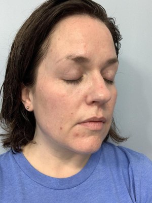 dr pimple popper target