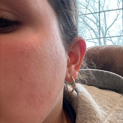 Guest review image 1 of 1, zoom in