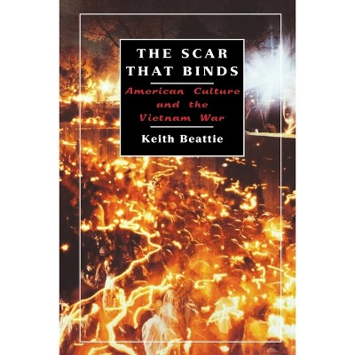 The Scar That Binds - by  Keith Beattie (Paperback)