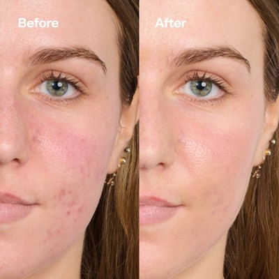 Bubble Skincare Secret Agent Color Correcting Balm Redness Fix - 0.5oz: Face Moisturizer, Paraben-Free, Gluten-Free, Normal Skin