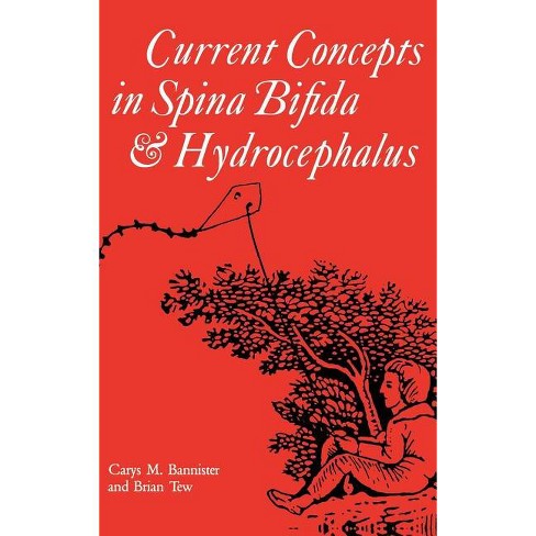 Current Concepts in Spina Bifida and Hydrocephalus - (Clinics in Developmental Medicine (Mac Keith Press)) by  Carys M Bannister & Brian Tew - image 1 of 1