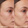 e.l.f. SKIN PLZ Clarify Facial Oil - 2% Salicylic Acid Acne Treatment + Aloe Extract - 1 fl oz - 4 of 4