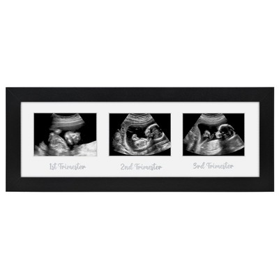 Americanflat Sonogram Picture Frame with Shatter-Resistant Glass, 15x5 Frame Fits Three 3x4 Sonograms with Interchangeable Mats, Black