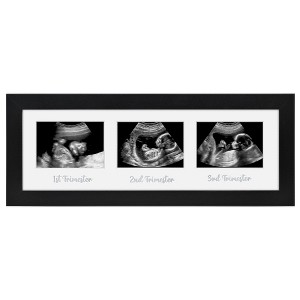 Americanflat Sonogram Picture Frame with Shatter-Resistant Glass, 15x5 Frame Fits Three 3x4 Sonograms with Interchangeable Mats, Black - 1 of 4