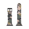 Marta Barragan Camarasa Abstract nature tropical 34 Apple Watch Band - Society6 - 3 of 3