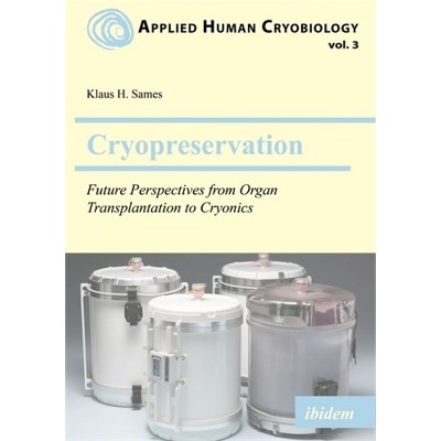 Cryopreservation - (Applied Human Cryobiology) by  Klaus Sames (Paperback)