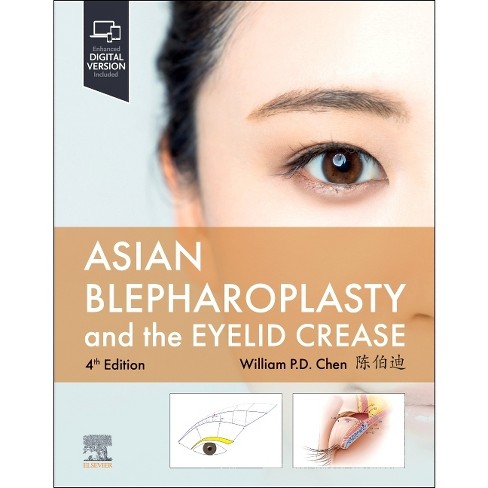 Asian Blepharoplasty And The Eyelid Crease - 4th Edition By