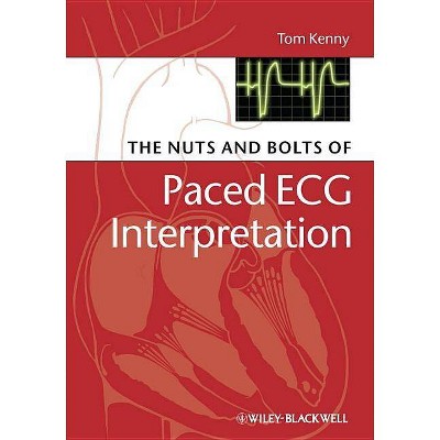 The Nuts and Bolts of Paced ECG Interpretation - (Nuts and Bolts Series (Replaced by 5113)) by  Tom Kenny (Paperback)