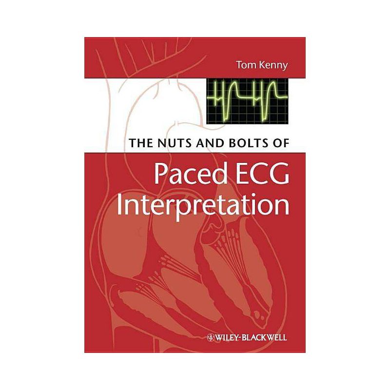 The Nuts and Bolts of Paced ECG Interpretation - (Nuts and Bolts Series (Replaced by 5113)) by  Tom Kenny (Paperback), 1 of 2