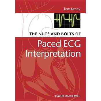 The Nuts and Bolts of Paced ECG Interpretation - (Nuts and Bolts Series (Replaced by 5113)) by  Tom Kenny (Paperback)
