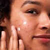 Hero Cosmetics Rescue Balm - 4 of 4