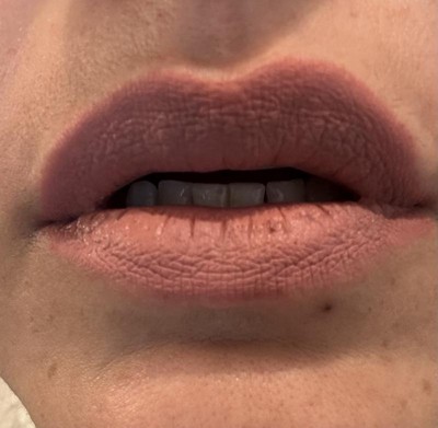 Guest review image 2 of 2, zoom in