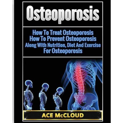 Osteoporosis - (Reverse or Prevent Bone Loss from Osteoporosis All) by  Ace McCloud (Paperback)